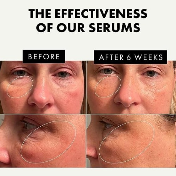 3 Facial Serums Set - Vitamin C Facial Serum, Retinol Facial Serum, Hyaluronic Acid Facial Serum - Anti-Aging Skincare Trio